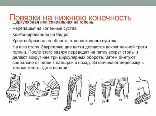 1. Какие типы повязок накладываются на голову(на грудь)? 2. Как накладывается повязка на верхнюю (ни