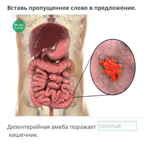 Вставь пропущенное слово в предложение. ￼Дизентерийная амеба поражает кишечник.​