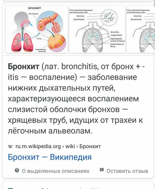 Заболевание дыхательной системы А) бронхит, грипп В) гипертония С) палиомалит Д) гиподинамия​