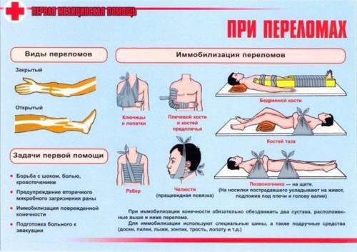 Какие из перечисленных правил являются основными для иммобилизации при открытом переломе?