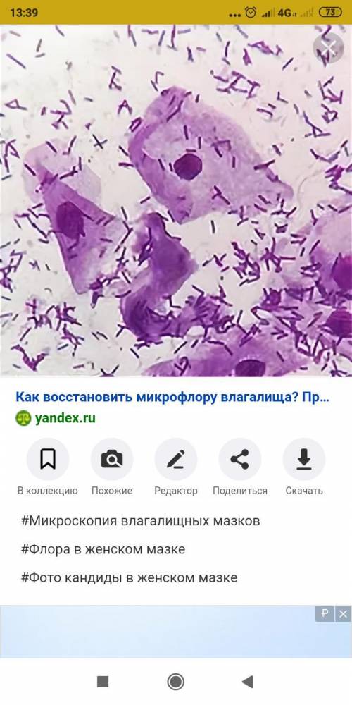 Определит форму бактерий по фото? хэээлп!