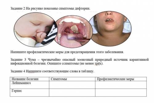 Задание 2 На рисунке показаны симптомы дифтерии.​