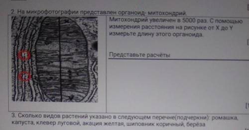 На микрофотографии представлен органоид- митохондрий. Митохондрий увеличен в 5000 раз. С измерения р