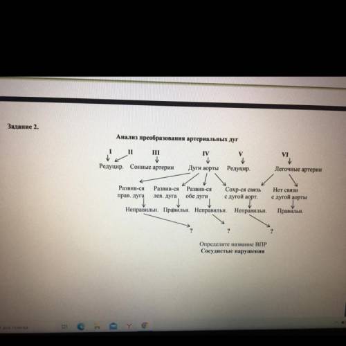 Анализ преобразования артериальных дуг V І VI ІІ ІІ IV Редуцир. Сонные артерии Дуги аорты Редуцир. Л