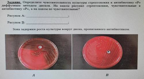 с МИКРОБИОЛОГИЕЙ Одно задание На фото