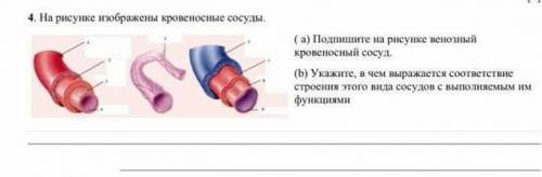 На рисунке изображены кровеносные сосуды. а)подпишите на рисунке венозный сосуд​