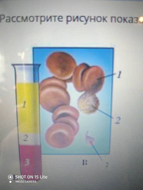у меня СОР (a)Соотнесите клетки крови, указанные на рисунке под №1-№3 с их названиями(б)Опишите стро