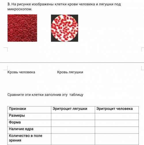 На рисунке изображены клетки крови человека и лягушки под микроскопом. Кровь человека Кровь лягушки