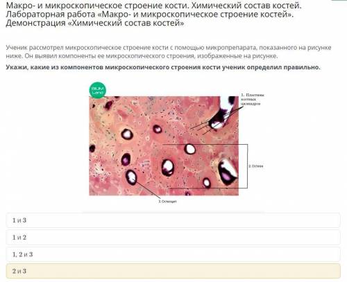 Ученик рассмотрел микроскопическое строение кости с микропрепарата, показанного на рисунке ниже. Он