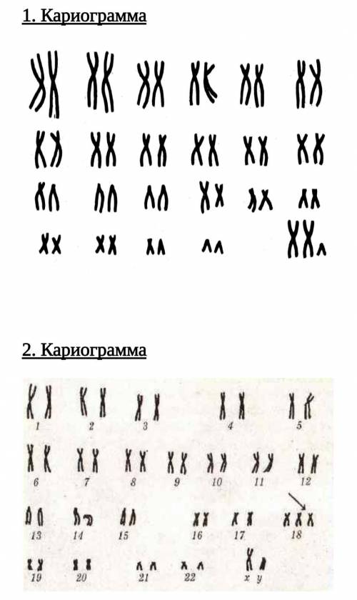 Сделайте анализ кариограммы человека по следующему плану. 1. Определите кариотип. 2. Определите пол