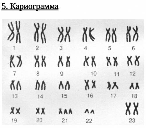 Сделайте анализ кариограммы человека по следующему плану. 1. Определите кариотип. 2. Определите пол