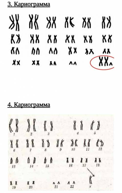 Сделайте анализ кариограммы человека по следующему плану. 1. Определите кариотип. 2. Определите пол