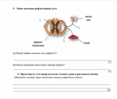 1. (а) Определите органы выделения жука и собаки. Жук Собака A. Антеннальные почки Мочеточники B. По