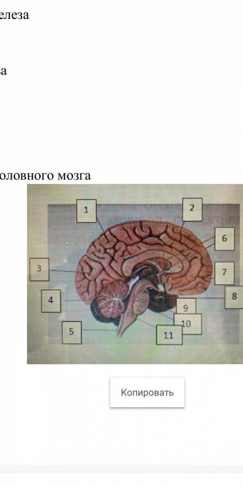 Подпишите отделы головного мозга Ваши ответы: 1 2 3 4 5 6 7 8 9 10 11