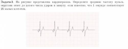 На рисунке представлена кардиограмма. Определите среднюю частоту пульса, округлив ответ до целого чи