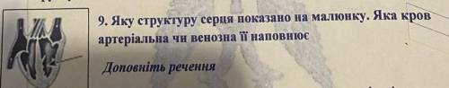 Яку структуру серця показано на малюнку яка кров артеріальна чи виновна її наповнює