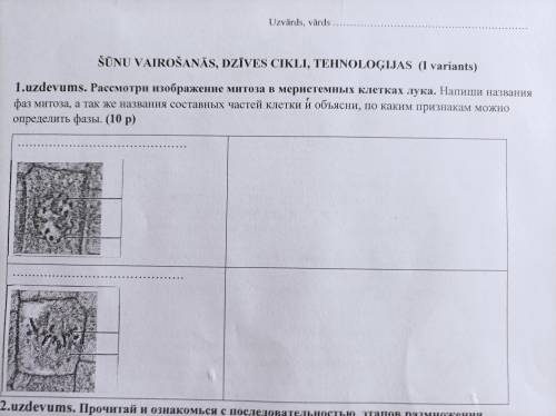 Рассмотри изображение митоза в меристемных клетках лука. Напиши название фаз митоза, а так же состав